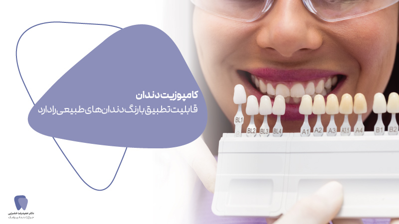 فواید و مزایای کامپوزیت دندان