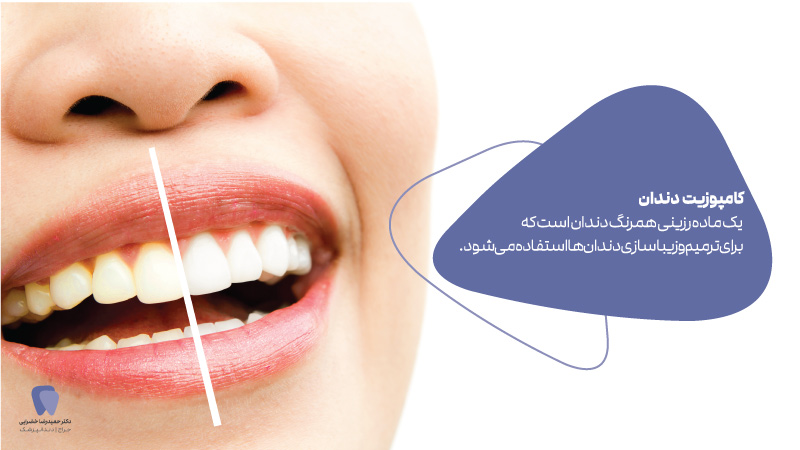 کاربرد کامپوزیت