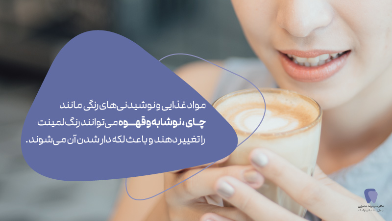 مراقبت های بعد از لمینت دندان