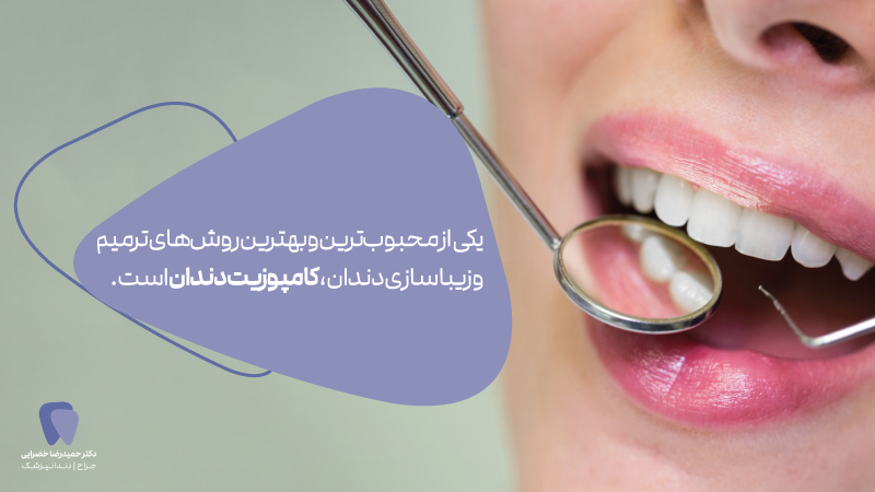مراقبت های بعد از کامپوزیت دندان