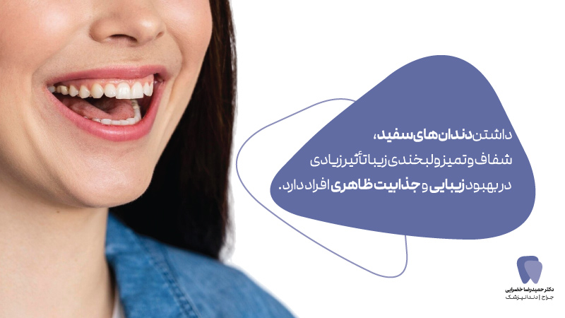 بلیچینگ دندان